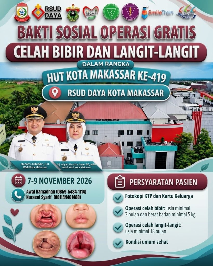 Kolaborasi RSUD Daya–RSGM Unhas, Warga Bisa Akses Operasi Celah Bibir Gratis